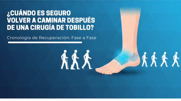 ¿Cuándo es seguro volver a caminar después de una Cirugía de Tobillo?